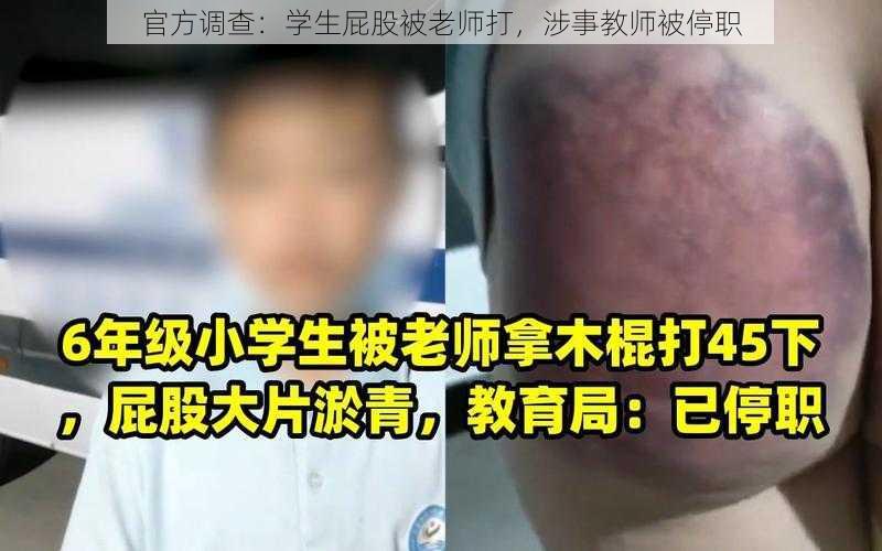 官方调查：学生屁股被老师打，涉事教师被停职